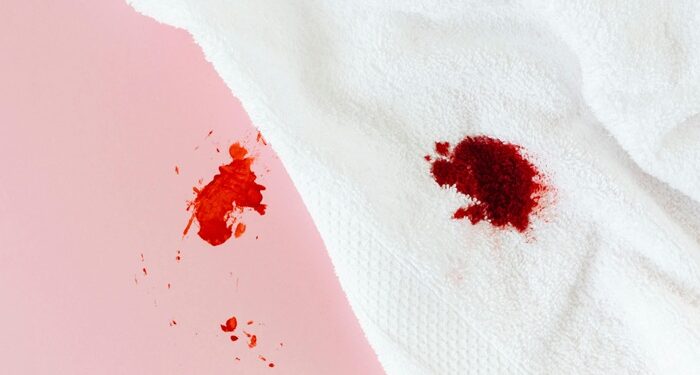 How to get the dried blood stains out from the clothes
