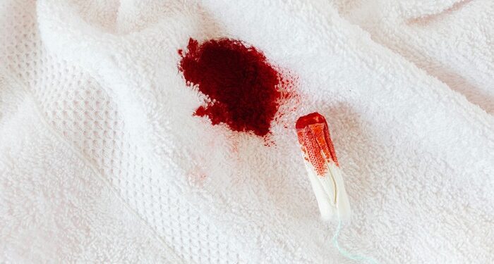 How to remove fresh blood stains
